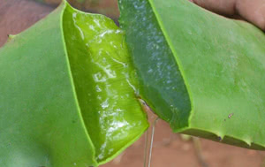 Gel di Aloe vera