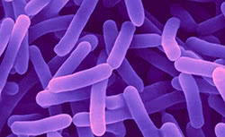 Bifidobacterium infantis