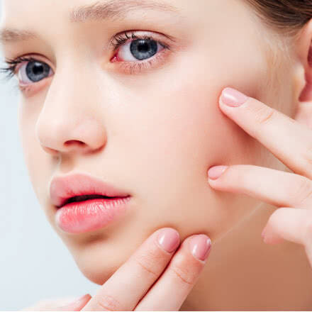 Prodotti per acne e pelli impure